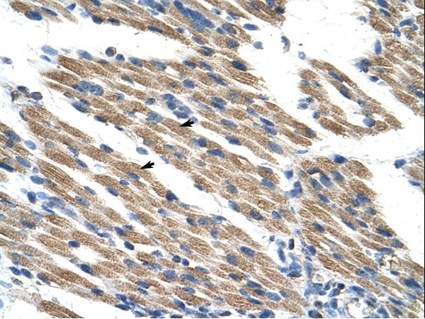 KEAP1 Antibody - KEAP1 antibody ARP38981_P050-NP_987096-KEAP1 (kelch-like ECH-associated protein 1) Antibody was used in IHC to stain formalin-fixed, paraffin-embedded human muscle.  This image was taken for the unconjugated form of this product. Other forms have not been tested.