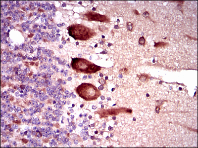 KEAP1 Antibody - IHC of paraffin-embedded cerebellum tissues using KEAP1 mouse monoclonal antibody with DAB staining.