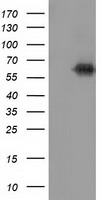 KEAP1 Antibody - HEK293T cells were transfected with the pCMV6-ENTRY control (Left lane) or pCMV6-ENTRY KEAP1 (Right lane) cDNA for 48 hrs and lysed. Equivalent amounts of cell lysates (5 ug per lane) were separated by SDS-PAGE and immunoblotted with anti-KEAP1.