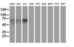 KEAP1 Antibody - Western blot of extracts (35 ug) from 9 different cell lines by using anti-KEAP1 monoclonal antibody.