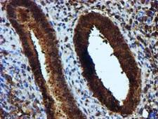 KEAP1 Antibody - IHC of paraffin-embedded Human endometrium tissue using anti-KEAP1 mouse monoclonal antibody.