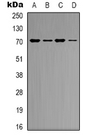 KEAP1 Antibody - Western blot analysis of KEAP1 expression in K562 (A); HeLa (B); mouse heart (C); mouse brain (D) whole cell lysates.