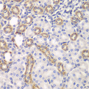 KEAP1 Antibody - Immunohistochemistry of paraffin-embedded rat kidney tissue.