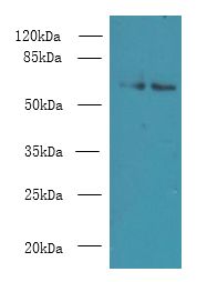KEAP1 Antibody - Western blot. All lanes: Keap1 antibody at 9 ug/ml. Lane 1: 293T whole cell lysate. Lane 2: Jurkat whole cell lysate. Secondary antibody: Goat polyclonal to Rabbit IgG at 1:10000 dilution. Predicted band size: 63 kDa. Observed band size: 63 kDa.