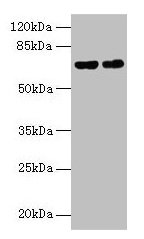KEAP1 Antibody - Western blot All lanes: Keap1 antibody at 9µg/ml Lane 1: 293T whole cell lysate Lane 2: Jurkat whole cell lysate Secondary Goat polyclonal to rabbit IgG at 1/10000 dilution Predicted band size: 63 kDa Observed band size: 63 kDa
