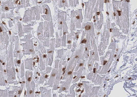 KEAP1 Antibody - 1:100 staining human heart muscle tissue by IHC-P. The tissue was formaldehyde fixed and a heat mediated antigen retrieval step in citrate buffer was performed. The tissue was then blocked and incubated with the antibody for 1.5 hours at 22°C. An HRP conjugated goat anti-rabbit antibody was used as the secondary.