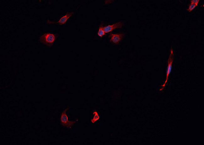 KEAP1 Antibody - Staining K562 cells by IF/ICC. The samples were fixed with PFA and permeabilized in 0.1% Triton X-100, then blocked in 10% serum for 45 min at 25°C. The primary antibody was diluted at 1:200 and incubated with the sample for 1 hour at 37°C. An Alexa Fluor 594 conjugated goat anti-rabbit IgG (H+L) antibody, diluted at 1/600, was used as secondary antibody.