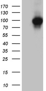 KEL / CD238 Antibody - HEK293T cells were transfected with the pCMV6-ENTRY control. (Left lane) or pCMV6-ENTRY KEL. (Right lane) cDNA for 48 hrs and lysed