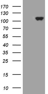 KEL / CD238 Antibody - HEK293T cells were transfected with the pCMV6-ENTRY control. (Left lane) or pCMV6-ENTRY KEL. (Right lane) cDNA for 48 hrs and lysed. Equivalent amounts of cell lysates. (5 ug per lane) were separated by SDS-PAGE and immunoblotted with anti-KEL. (1:500)