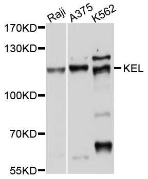 KEL / CD238 Antibody - Western blot analysis of extracts of various cell lines, using KEL antibody at 1:1000 dilution. The secondary antibody used was an HRP Goat Anti-Rabbit IgG (H+L) at 1:10000 dilution. Lysates were loaded 25ug per lane and 3% nonfat dry milk in TBST was used for blocking. An ECL Kit was used for detection and the exposure time was 20s.