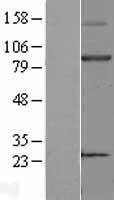KEL / CD238 Protein - Western validation with an anti-DDK antibody * L: Control HEK293 lysate R: Over-expression lysate