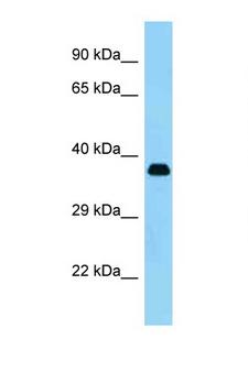 KERA / Keratocan Antibody - KERA antibody Western blot of Small Intestine lysate. Antibody concentration 1 ug/ml. This image was taken for the unconjugated form of this product. Other forms have not been tested.