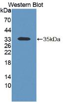 KERA / Keratocan Antibody - Western Blot; Sample: Recombinant protein.