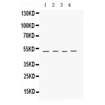 KERA / Keratocan Antibody - Keratocan antibody Western blot. All lanes: Anti Keratocan at 0.5 ug/ml. Lane 1: Mouse Testis Whole Cell Lysate at 40 ug. Lane 2: Mouse Skeletal Muscle Whole Cell Lysate at 40 ug. Lane 3: MCF-7 Whole Cell Lysate at 40 ug. Lane 4: A549 Whole Cell Lysate at 40 ug. Predicted band size: 40 kD. Observed band size: 50 kD.