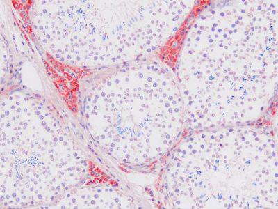 Keratin, Basal Cell Antibody - Clone PLB42 swine testis, paraffin section