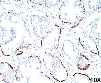 Keratin, HMW Antibody - HMW Cytokeratin antibody 34BE12 immunohistochemistry prostate 1.  This image was taken for the unmodified form of this product. Other forms have not been tested.