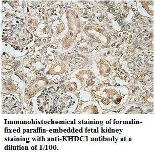 KHDC1 / C6orf148 Antibody