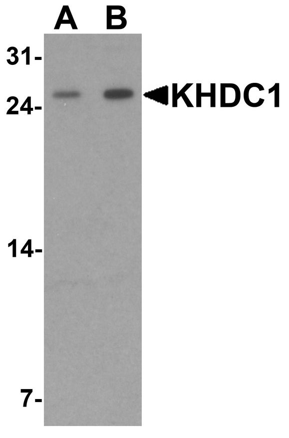 KHDC1 / C6orf148 Antibody - Western blot analysis of KHDC1 in rat liver tissue lysate with KHDC1 antibody at (A) 0.5 and (B) 1 ug/ml.