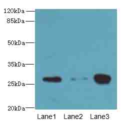 KHDC1 / C6orf148 Antibody - Western blot. All lanes: KHDC1 antibody at 5 ug/ml. Lane 1: Mouse liver tissue. Lane 2: Mouse kidney tissue. Lane 3: Mouse gonadal tissue. Secondary Goat polyclonal to Rabbit IgG at 1:10000 dilution. Predicted band size: 27 kDa. Observed band size: 27 kDa.