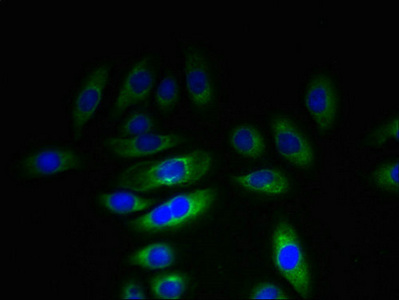 KHDC1 / C6orf148 Antibody - Immunofluorescent analysis of A549 cells using KHDC1 Antibody at dilution of 1:100 and Alexa Fluor 488-congugated AffiniPure Goat Anti-Rabbit IgG(H+L)
