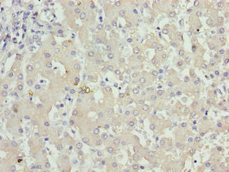 KHDC1 / C6orf148 Antibody - Immunohistochemistry of paraffin-embedded human liver tissue using KHDC1 Antibody at dilution of 1:100