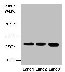 KHDC1 / C6orf148 Antibody - Western blot All lanes: KHDC1 antibody at 5µg/ml Lane 1: Mouse liver tissue Lane 2: Mouse kidney tissue Lane 3: Mouse gonadal tissue Secondary Goat polyclonal to rabbit IgG at 1/10000 dilution Predicted band size: 28, 19 kDa Observed band size: 28 kDa
