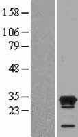 KHDC3L / ECAT1 Protein - Western validation with an anti-DDK antibody * L: Control HEK293 lysate R: Over-expression lysate