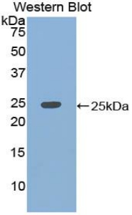 KHDRBS1 / SAM68 Antibody - Western blot of recombinant KHDRBS1 / SAM68 / p62.
