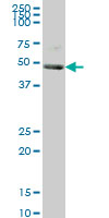 KHDRBS1 / SAM68 Antibody - KHDRBS1 monoclonal antibody (M03), clone 1A4 Western blot of KHDRBS1 expression in A-431.