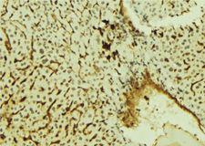 KHDRBS1 / SAM68 Antibody - 1:100 staining mouse liver tissue by IHC-P. The sample was formaldehyde fixed and a heat mediated antigen retrieval step in citrate buffer was performed. The sample was then blocked and incubated with the antibody for 1.5 hours at 22°C. An HRP conjugated goat anti-rabbit antibody was used as the secondary.
