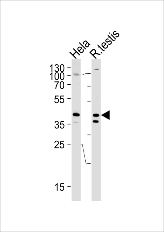 KHDRBS2 / SLM-1 Antibody - KHDRBS2 Antibody western blot of HeLa cell line and rat testis tissue lysates (35 ug/lane). The KHDRBS2 antibody detected the KHDRBS2 protein (arrow).