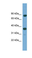 KHDRBS2 / SLM-1 Antibody - KHDRBS2 antibody Western blot of Fetal Lung lysate. This image was taken for the unconjugated form of this product. Other forms have not been tested.