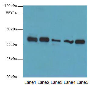 KHDRBS2 / SLM-1 Antibody - Western blot. All lanes: KHDRBS2 antibody at 7 ug/ml. Lane 1: K562 whole cell lysate. Lane 2: HeLa whole cell lysate. Lane 3: A431 whole cell lysate. Lane 4: Jurkat whole cell lysate. Lane 5: NIH/3T3 whole cell lysate. Secondary Goat polyclonal to Rabbit IgG at 1:10000 dilution. Predicted band size: 39 kDa. Observed band size: 39 kDa.