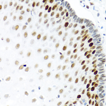 KHDRBS2 / SLM-1 Antibody - Immunohistochemistry of paraffin-embedded human esophagus.