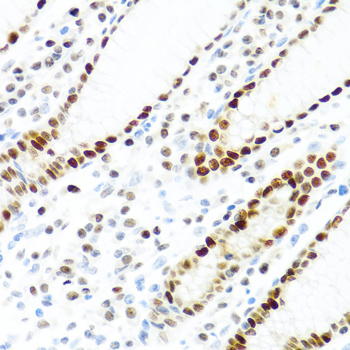 KHDRBS2 / SLM-1 Antibody - Immunohistochemistry of paraffin-embedded human stomach tissue.