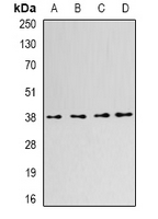 KHDRBS2 / SLM-1 Antibody - Western blot analysis of SLM-1 expression in HeLa (A); K562 (B); MCF7 (C); NIH3T3 (D) whole cell lysates.