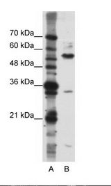 KHDRBS3 / SLM2 Antibody - A: Marker, B: Jurkat Cell Lysate.  This image was taken for the unconjugated form of this product. Other forms have not been tested.