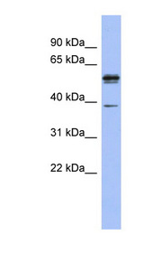 KHDRBS3 / SLM2 Antibody - KHDRBS3 / SLM2 antibody Western blot of Fetal Stomach lysate. This image was taken for the unconjugated form of this product. Other forms have not been tested.