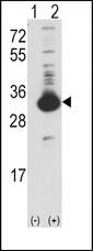 KHK / Ketohexokinase Antibody - Western blot of KHK (arrow) using rabbit polyclonal Ketohexokinase (KHK) Antibody. 293 cell lysates (2 ug/lane) either nontransfected (Lane 1) or transiently transfected with the KHK gene (Lane 2) (Origene Technologies).