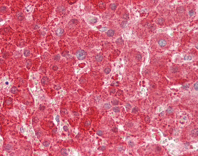 KHK / Ketohexokinase Antibody - Human Liver: Formalin-Fixed, Paraffin-Embedded (FFPE).  This image was taken for the unconjugated form of this product. Other forms have not been tested.