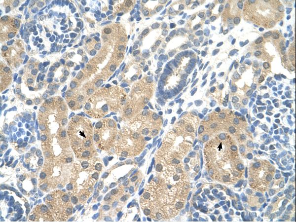 KHK / Ketohexokinase Antibody - KHK / Ketohexokinase antibody KHK(ketohexokinase (fructokinase)) Antibody was used in IHC to stain formalin-fixed, paraffin-embedded human kidney.  This image was taken for the unconjugated form of this product. Other forms have not been tested.