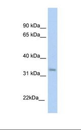 KHK / Ketohexokinase Antibody - Fetal liver cell lysate. Antibody concentration: 1.0 ug/ml. Gel concentration: 12%.  This image was taken for the unconjugated form of this product. Other forms have not been tested.