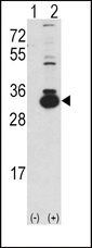 KHK / Ketohexokinase Antibody - Western blot of KHK (arrow) using rabbit polyclonal Ketohexokinase (KHK) Antibody. 293 cell lysates (2 ug/lane) either nontransfected (Lane 1) or transiently transfected with the KHK gene (Lane 2) (Origene Technologies).