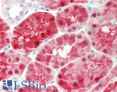 KHK / Ketohexokinase Antibody - Human Kidney: Formalin-Fixed, Paraffin-Embedded (FFPE).  This image was taken for the unconjugated form of this product. Other forms have not been tested.