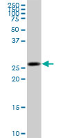 KHK / Ketohexokinase Antibody - KHK monoclonal antibody (M01), clone 1H6-2B6. Western blot of KHK expression in human liver.