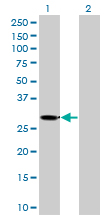 KHK / Ketohexokinase Antibody - Western blot of KHK expression in transfected 293T cell line by KHK monoclonal antibody (M01), clone 1H6-2B6.