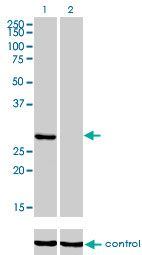 KHK / Ketohexokinase Antibody - Western blot of KHK over-expressed 293 cell line, cotransfected with KHK Validated Chimera RNAi (Lane 2) or non-transfected control (Lane 1). Blot probed with KHK monoclonal antibody, clone 1H6-2B6. GAPDH ( 36.1 kD ) used as specificity a.
