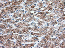 KHK / Ketohexokinase Antibody - IHC of paraffin-embedded Human liver tissue using anti-KHK mouse monoclonal antibody. (Dilution 1:50).