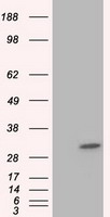 KHK / Ketohexokinase Antibody - HEK293T cells were transfected with the pCMV6-ENTRY control (Left lane) or pCMV6-ENTRY KHK (Right lane) cDNA for 48 hrs and lysed. Equivalent amounts of cell lysates (5 ug per lane) were separated by SDS-PAGE and immunoblotted with anti-KHK.