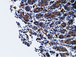 KHK / Ketohexokinase Antibody - IHC of paraffin-embedded Human breast tissue using anti-KHK mouse monoclonal antibody.